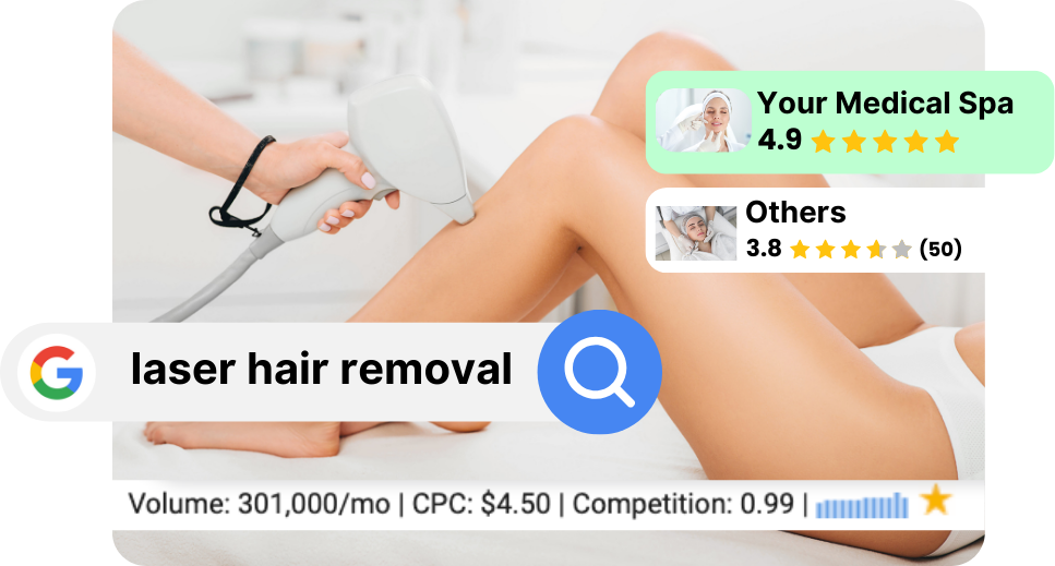 laser hair removal